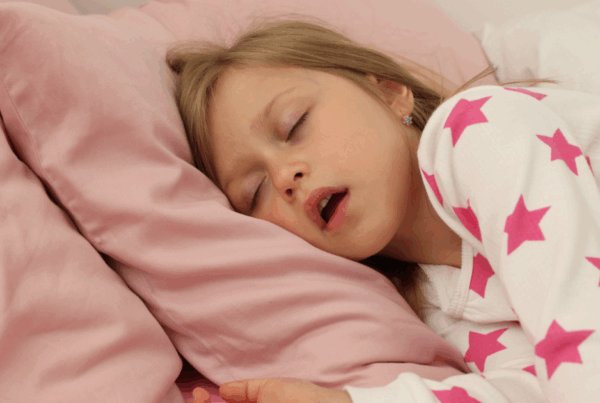 Child sleeping with mouth open, showing signs of mouth breathing during sleep